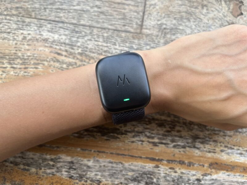 Front view of the battery pack